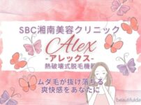 SBC-alex-eyecatch02-min
