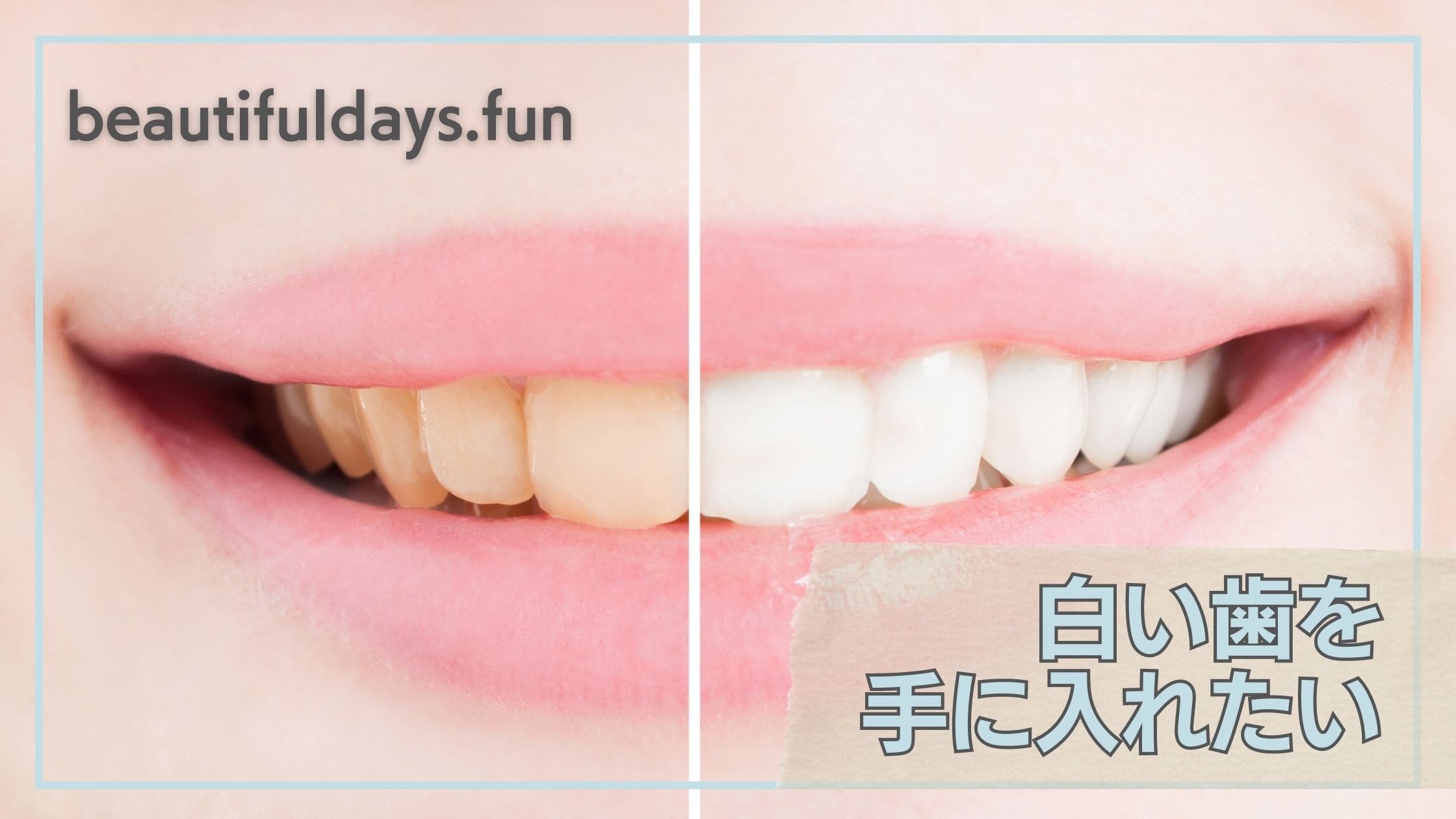 WDC-white-teeth-min