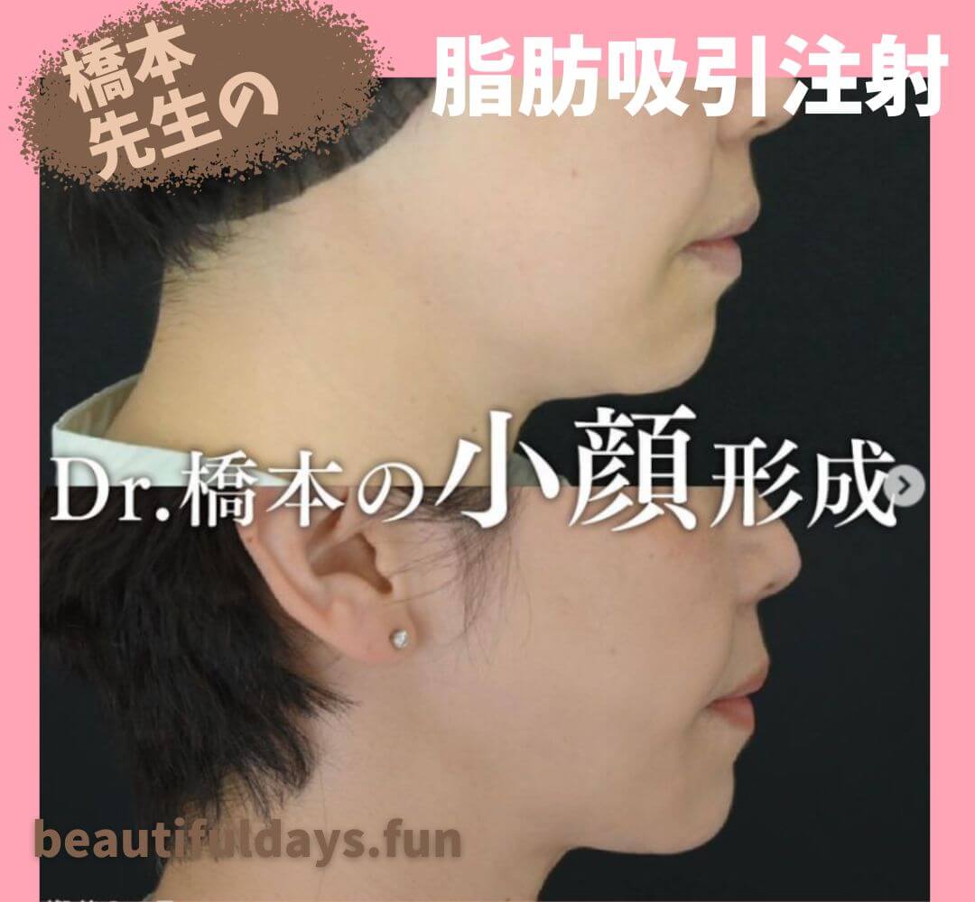 Dr.hashimoto-01-1