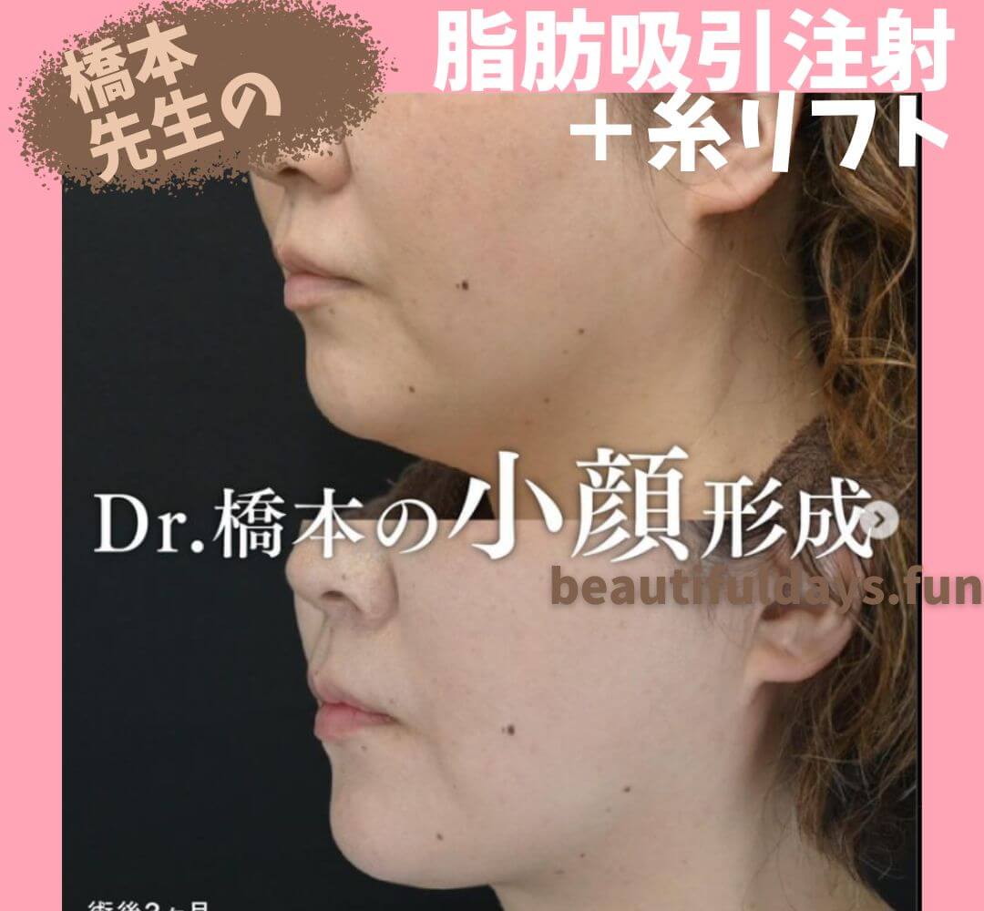 Dr.hashimoto-02-1